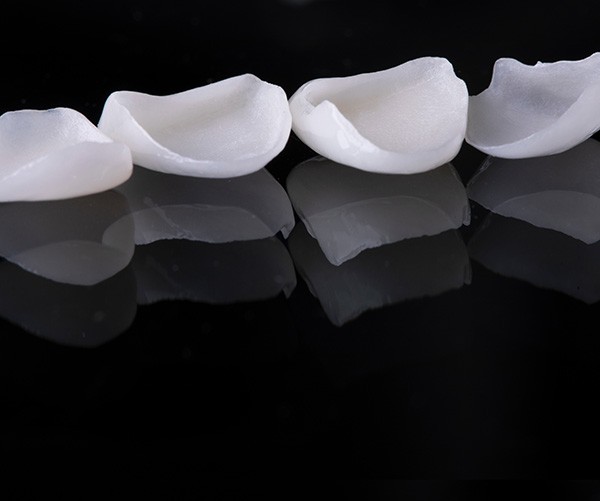 4 veneers in a row on a reflective black surface